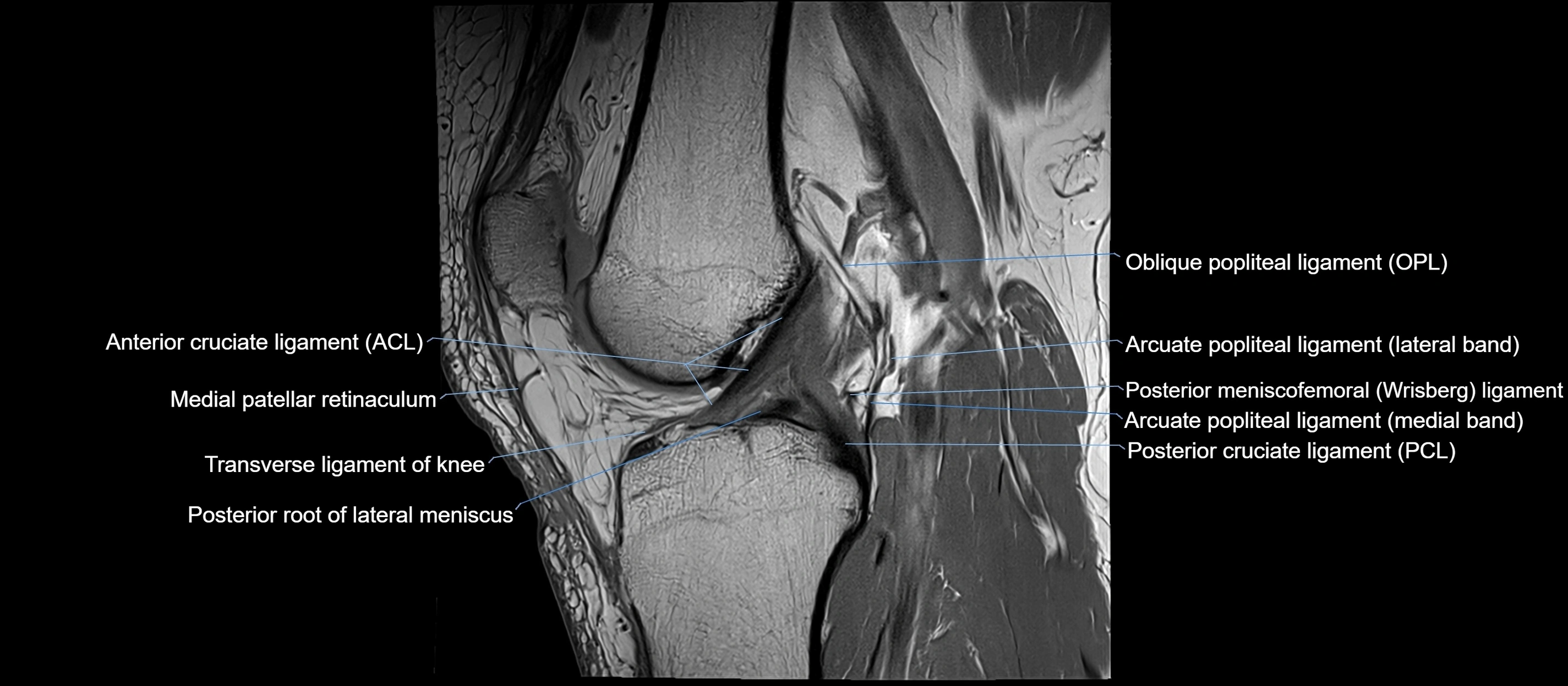 MRI sagittal  ligaments cross sectional anatomy 3T  radiology  image-img-00001-00026.webp